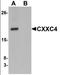 CXXC Finger Protein 4 antibody, orb95546, Biorbyt, Western Blot image 