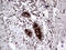 Anterior Gradient 2, Protein Disulphide Isomerase Family Member antibody, LS-C792226, Lifespan Biosciences, Immunohistochemistry paraffin image 