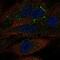 Tudor Domain Containing 10 antibody, NBP2-55434, Novus Biologicals, Immunofluorescence image 