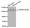 Neurotrophic Receptor Tyrosine Kinase 1 antibody, MBS128540, MyBioSource, Western Blot image 