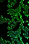 Ubiquitin-conjugating enzyme E2 B antibody, orb247363, Biorbyt, Immunofluorescence image 