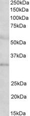 Insulin Like Growth Factor Binding Protein 1 antibody, EB11949, Everest Biotech, Western Blot image 