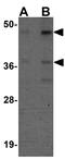 Sirtuin 7 antibody, GTX85103, GeneTex, Western Blot image 
