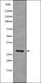 Linker For Activation Of T Cells antibody, orb336104, Biorbyt, Western Blot image 