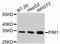 Pim-1 Proto-Oncogene, Serine/Threonine Kinase antibody, abx125380, Abbexa, Western Blot image 