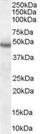 Serpin Family I Member 1 antibody, GTX89544, GeneTex, Western Blot image 