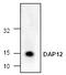 TYRO Protein Tyrosine Kinase Binding Protein antibody, TA319099, Origene, Western Blot image 