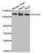 PTCH1 antibody, abx135709, Abbexa, Western Blot image 