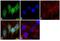 Proteasome 26S Subunit, Non-ATPase 14 antibody, 38-0200, Invitrogen Antibodies, Immunofluorescence image 