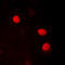 High Mobility Group Nucleosomal Binding Domain 2 antibody, abx133179, Abbexa, Western Blot image 