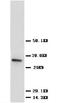 Cyclin Dependent Kinase 4 antibody, PA1428, Boster Biological Technology, Western Blot image 
