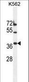 Transmembrane Protein 150B antibody, LS-C161984, Lifespan Biosciences, Western Blot image 