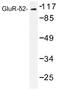 Glutamate Ionotropic Receptor Delta Type Subunit 2 antibody, AP01377PU-N, Origene, Western Blot image 