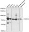 Hydroxyacyl-CoA Dehydrogenase Trifunctional Multienzyme Complex Subunit Alpha antibody, 14-909, ProSci, Western Blot image 