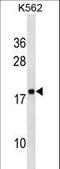 Ribosomal Protein Lateral Stalk Subunit P2 antibody, LS-B13078, Lifespan Biosciences, Western Blot image 