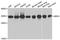 SBDS Ribosome Maturation Factor antibody, A5876, ABclonal Technology, Western Blot image 