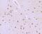 Interleukin Enhancer Binding Factor 2 antibody, A04443-1, Boster Biological Technology, Immunohistochemistry paraffin image 