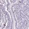 Zinc Finger Protein 334 antibody, PA5-62123, Invitrogen Antibodies, Immunohistochemistry frozen image 