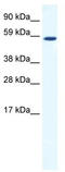 TATA-Box Binding Protein Associated Factor, RNA Polymerase I Subunit B antibody, TA342343, Origene, Western Blot image 