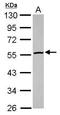 Cytosolic beta-glucosidase antibody, GTX116696, GeneTex, Western Blot image 