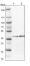 Eukaryotic Translation Initiation Factor 2B Subunit Beta antibody, NBP1-84877, Novus Biologicals, Western Blot image 