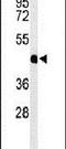 Hemojuvelin BMP Co-Receptor antibody, PA5-26703, Invitrogen Antibodies, Western Blot image 