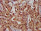 Carbohydrate Sulfotransferase 11 antibody, LS-C673928, Lifespan Biosciences, Immunohistochemistry paraffin image 