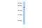 Acyl-CoA Synthetase Bubblegum Family Member 2 antibody, 26-833, ProSci, Western Blot image 