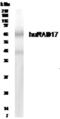 RAD17 Checkpoint Clamp Loader Component antibody, GTX30134, GeneTex, Western Blot image 