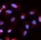 Baculoviral IAP Repeat Containing 5 antibody, FNab09909, FineTest, Immunofluorescence image 