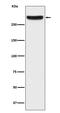 Inositol 1,4,5-Trisphosphate Receptor Type 1 antibody, M01465-1, Boster Biological Technology, Western Blot image 