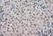 TGFB1-Induced Anti-Apoptotic Factor 1 antibody, FNab08686, FineTest, Immunohistochemistry paraffin image 
