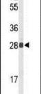 Tetraspanin 1 antibody, PA5-26016, Invitrogen Antibodies, Western Blot image 