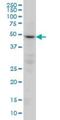 Protein Phosphatase 2 Regulatory Subunit Bgamma antibody, H00005522-M01, Novus Biologicals, Western Blot image 