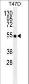 TNF Receptor Associated Factor 2 antibody, LS-C160156, Lifespan Biosciences, Western Blot image 