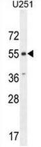 Atypical Chemokine Receptor 3 antibody, AP50982PU-N, Origene, Western Blot image 