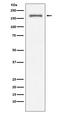 Integrin Subunit Alpha L antibody, M04466-1, Boster Biological Technology, Western Blot image 