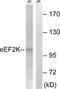 Eukaryotic Elongation Factor 2 Kinase antibody, LS-B9878, Lifespan Biosciences, Western Blot image 