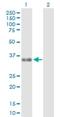 Zinc Finger Matrin-Type 3 antibody, H00064393-D01P, Novus Biologicals, Western Blot image 