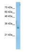 Testis Expressed 264, ER-Phagy Receptor antibody, NBP1-62424, Novus Biologicals, Western Blot image 