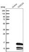 Small Vasohibin Binding Protein antibody, PA5-52569, Invitrogen Antibodies, Western Blot image 