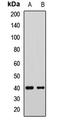 G Protein Subunit Alpha I2 antibody, LS-C668395, Lifespan Biosciences, Western Blot image 