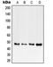 TNF Receptor Superfamily Member 1B antibody, LS-C352952, Lifespan Biosciences, Western Blot image 