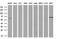 Acyl-CoA Synthetase Family Member 2 antibody, MA5-25957, Invitrogen Antibodies, Western Blot image 