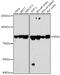 Interferon Gamma Inducible Protein 16 antibody, GTX54298, GeneTex, Western Blot image 