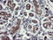 Ubiquitin Specific Peptidase 10 antibody, LS-C173656, Lifespan Biosciences, Immunohistochemistry paraffin image 