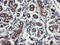 Ubiquitin carboxyl-terminal hydrolase 10 antibody, LS-C173656, Lifespan Biosciences, Immunohistochemistry paraffin image 