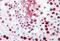Heterogeneous Nuclear Ribonucleoprotein L antibody, MBS247000, MyBioSource, Immunohistochemistry frozen image 