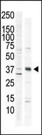 Calcium/Calmodulin Dependent Protein Kinase I antibody, MBS9201566, MyBioSource, Western Blot image 