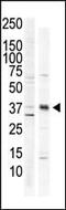 Calcium/calmodulin-dependent protein kinase type 1 antibody, MBS9201566, MyBioSource, Western Blot image 